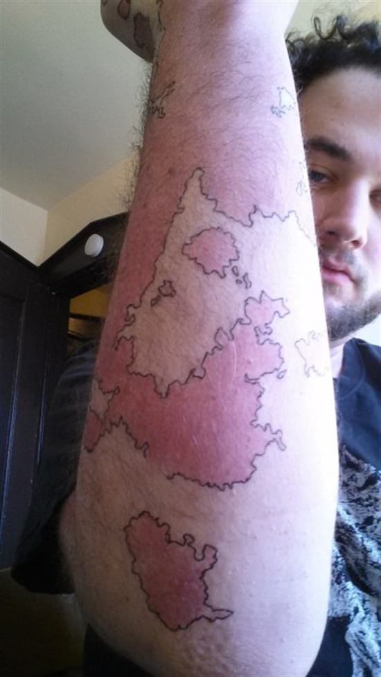 Man Transforms His Birthmark Into A Map Of A New World