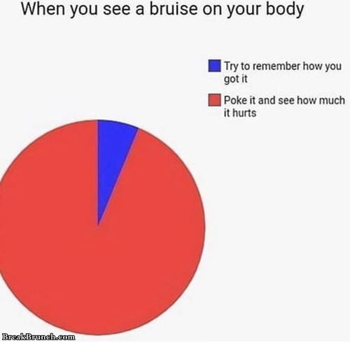 when-you-see-bruise-062319