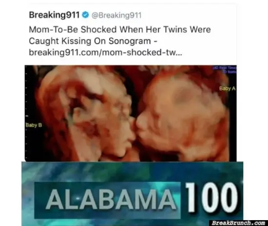 Twins kissing on sonogram