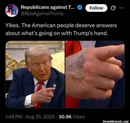 Something is wrong with Trump