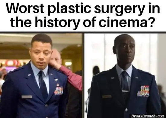 Worst plastic surgery in history of cinema